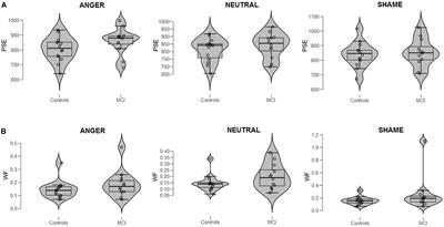 Lack of Temporal Impairment in Patients With Mild Cognitive Impairment